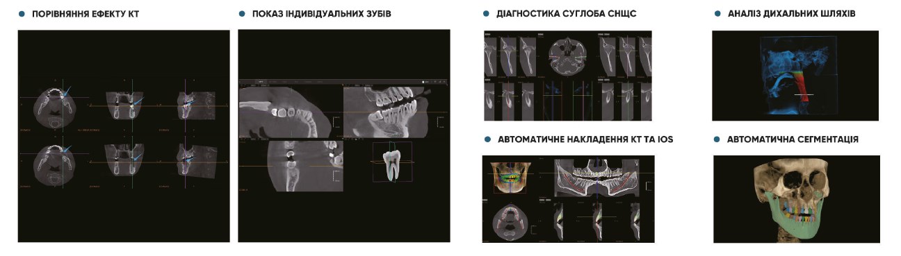 Рентгенівська система D50 FUSSEN/GALIT