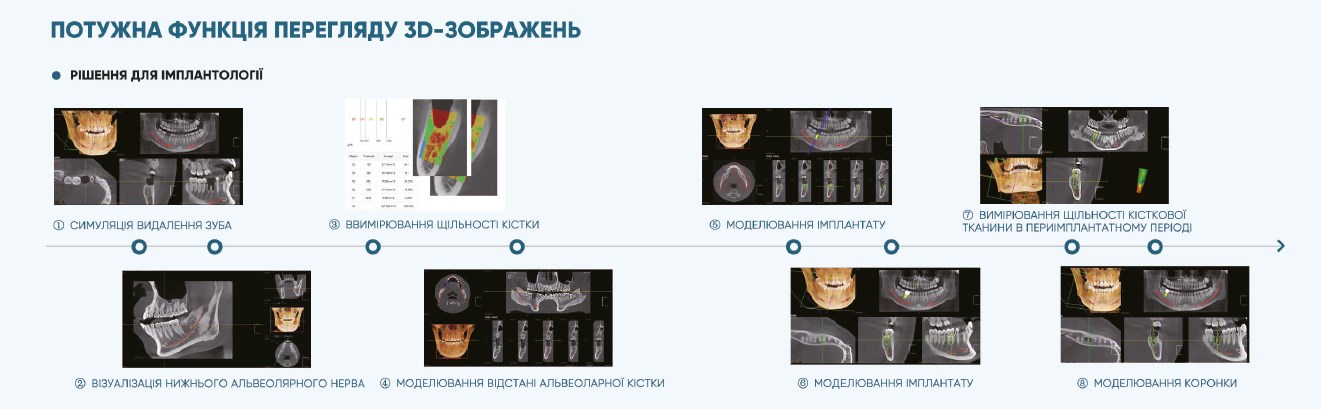 Рентгенівська система D50 FUSSEN/GALIT