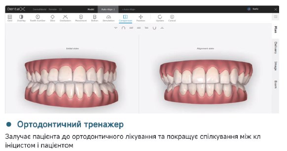 характеристика інраорального сканера ортодонтичний тренажер