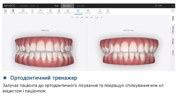 характеристика інтраорального сканера Fussen